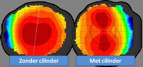 Cilinderlenzen2 contactlenscentrum wfg - Hoorn NH