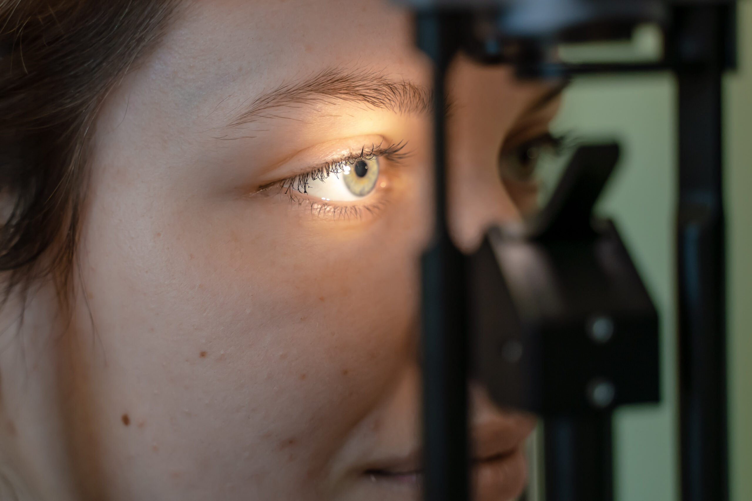 Onderzoek oogleden droge ogen Contactlenscentrum WFG